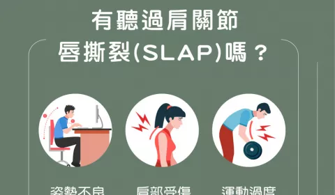 上關節唇前後撕裂（SLAP lesion, superior labrum anterior posterior tear）